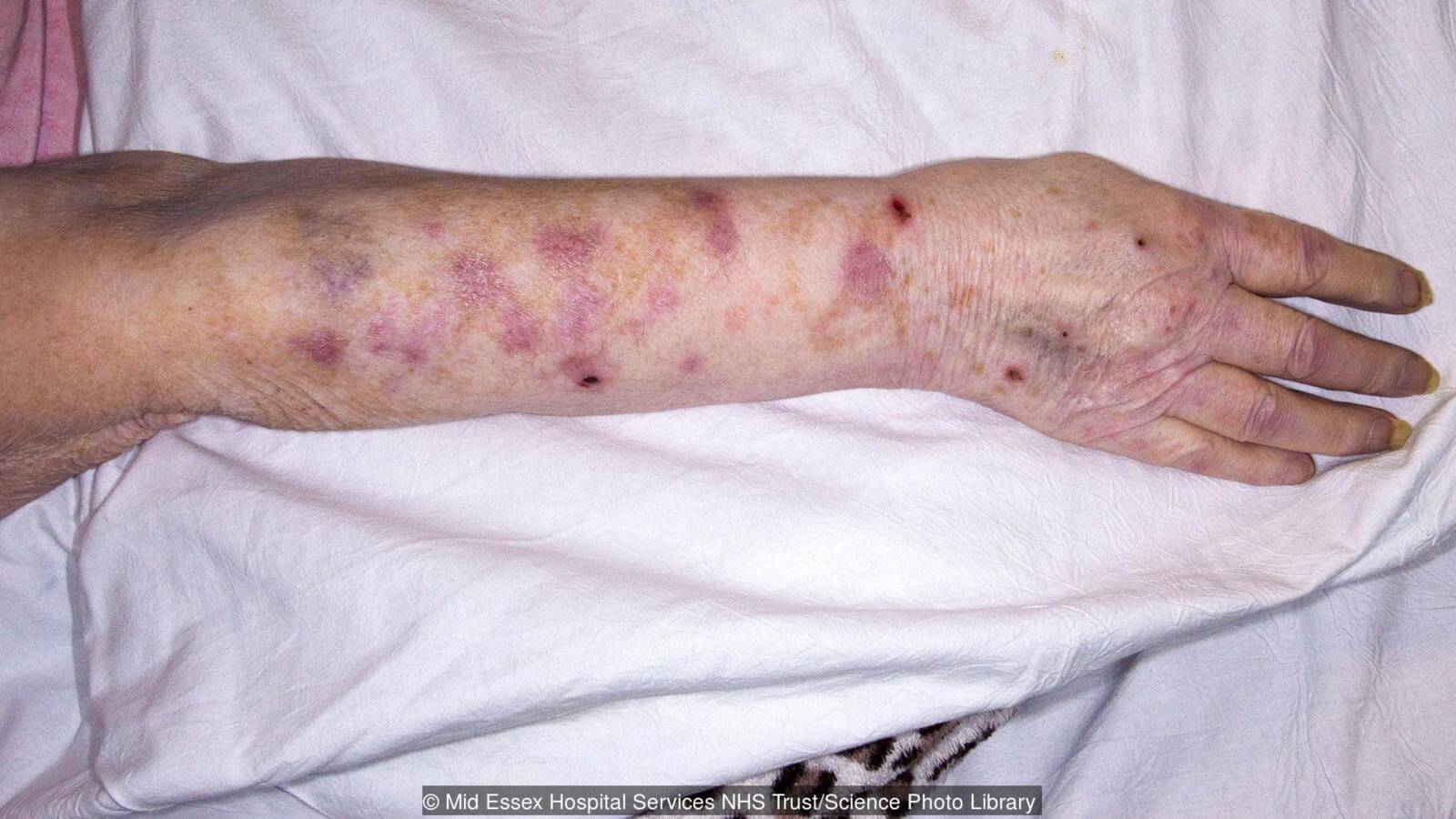 Иногда без обезболивающих никак. Фото.