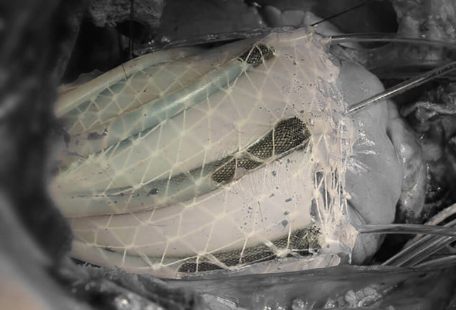 Силиконовый робот поможет сердцу биться. Фото.