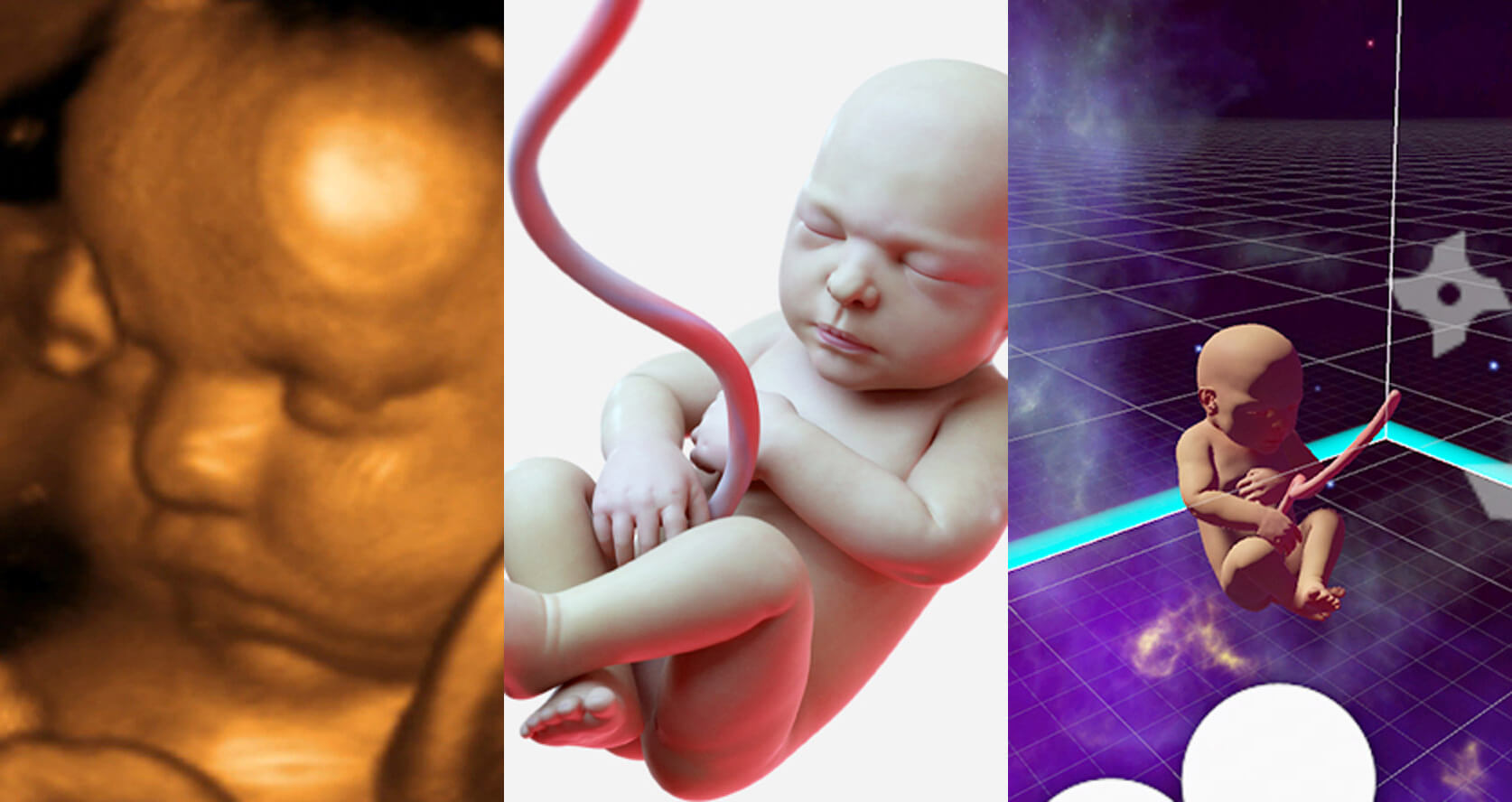 Виртуальная реальность позволила родителям познакомиться с пока ещё не родившейся дочкой. Фото.