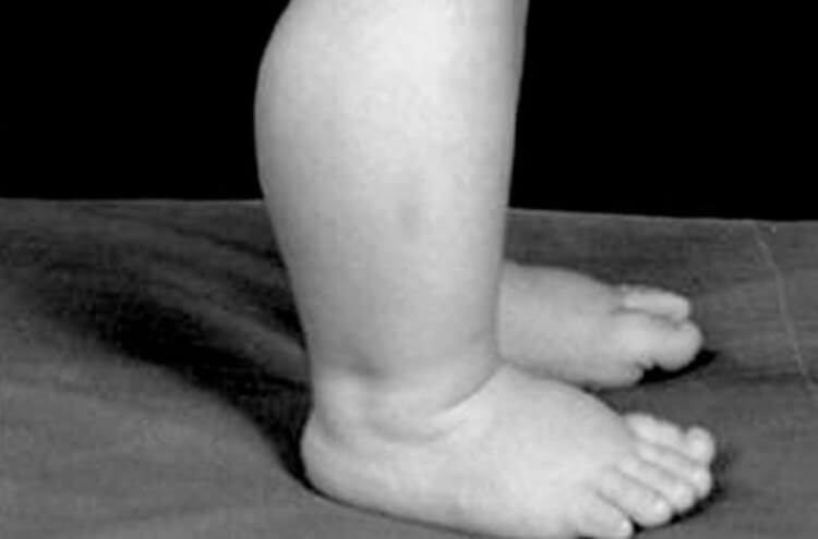 Стать силачом хотели многие. Фото.