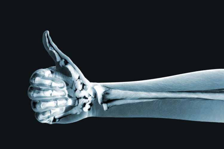 Российские ученые испытали костные имплантаты из сверхвысокомолекулярного полиэтилена. Фото.