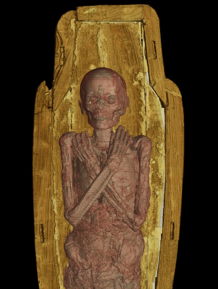 Современные технологии позволяют узнать самые сокровенные секреты мумий. Куда девают органы мумий? Фото.