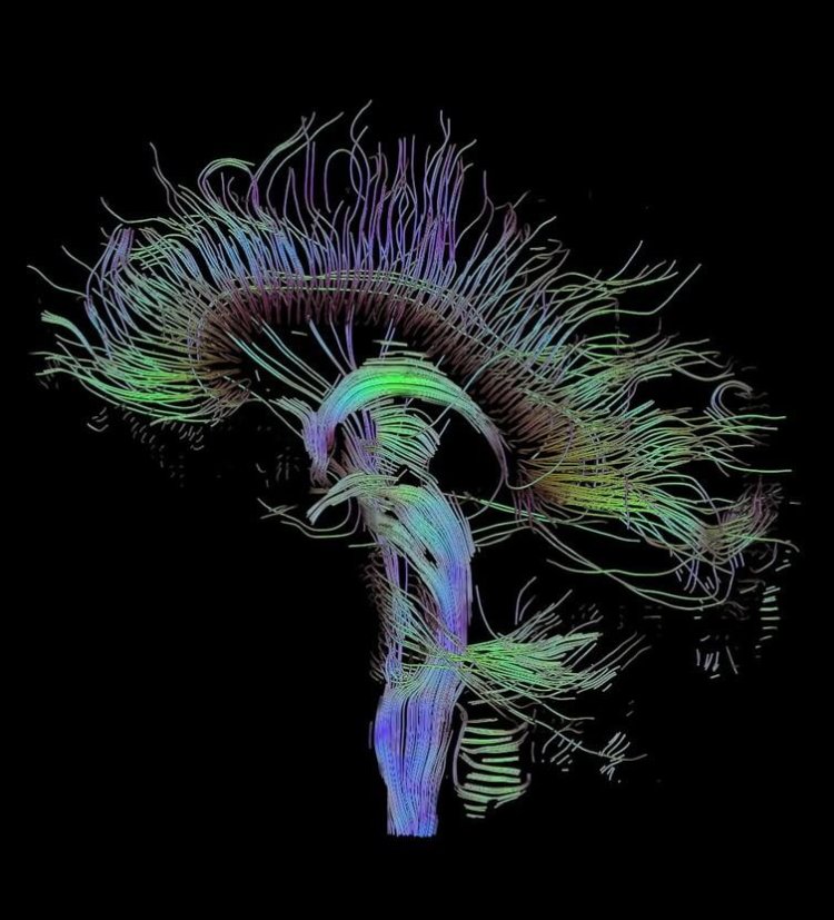 Как понять мозг. Абстрактная мозговая красота. Фото.