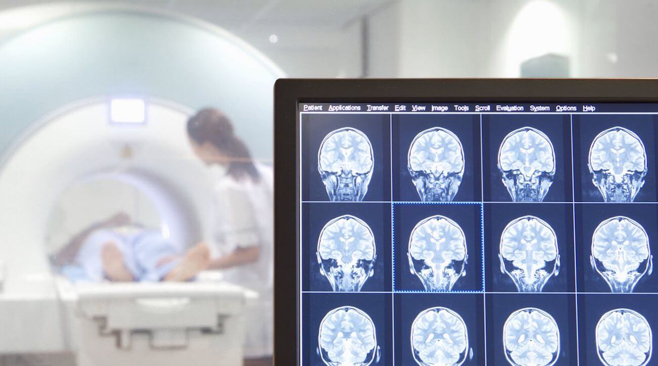 Мыслить как преступник. Правонарушителей можно вычислить по снимку мозга. Фото.