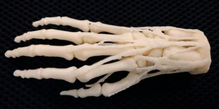 Американские госпитали начнут печатать протезы на 3D-принтерах. Фото.