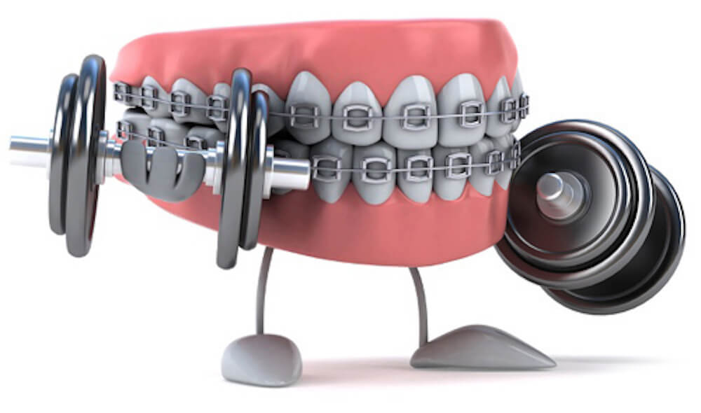 В США начались испытания системы, способной заменить брекеты. Фото.