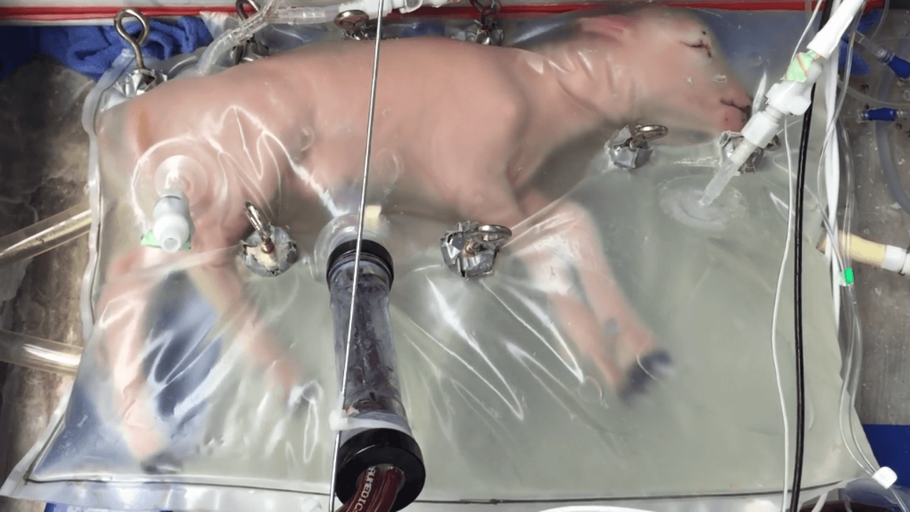 Учёные создали искусственную матку для недоношенных детей. Фото.
