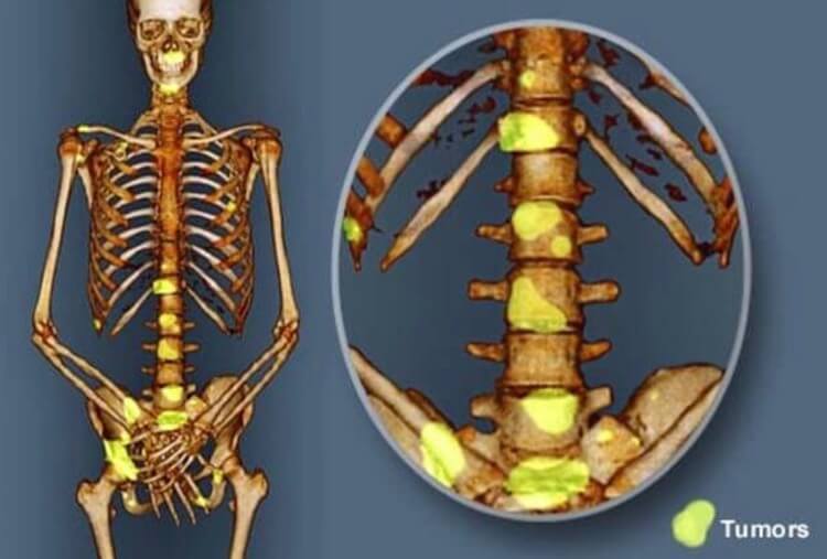 Организм человека пострадает куда глубже. Фото.