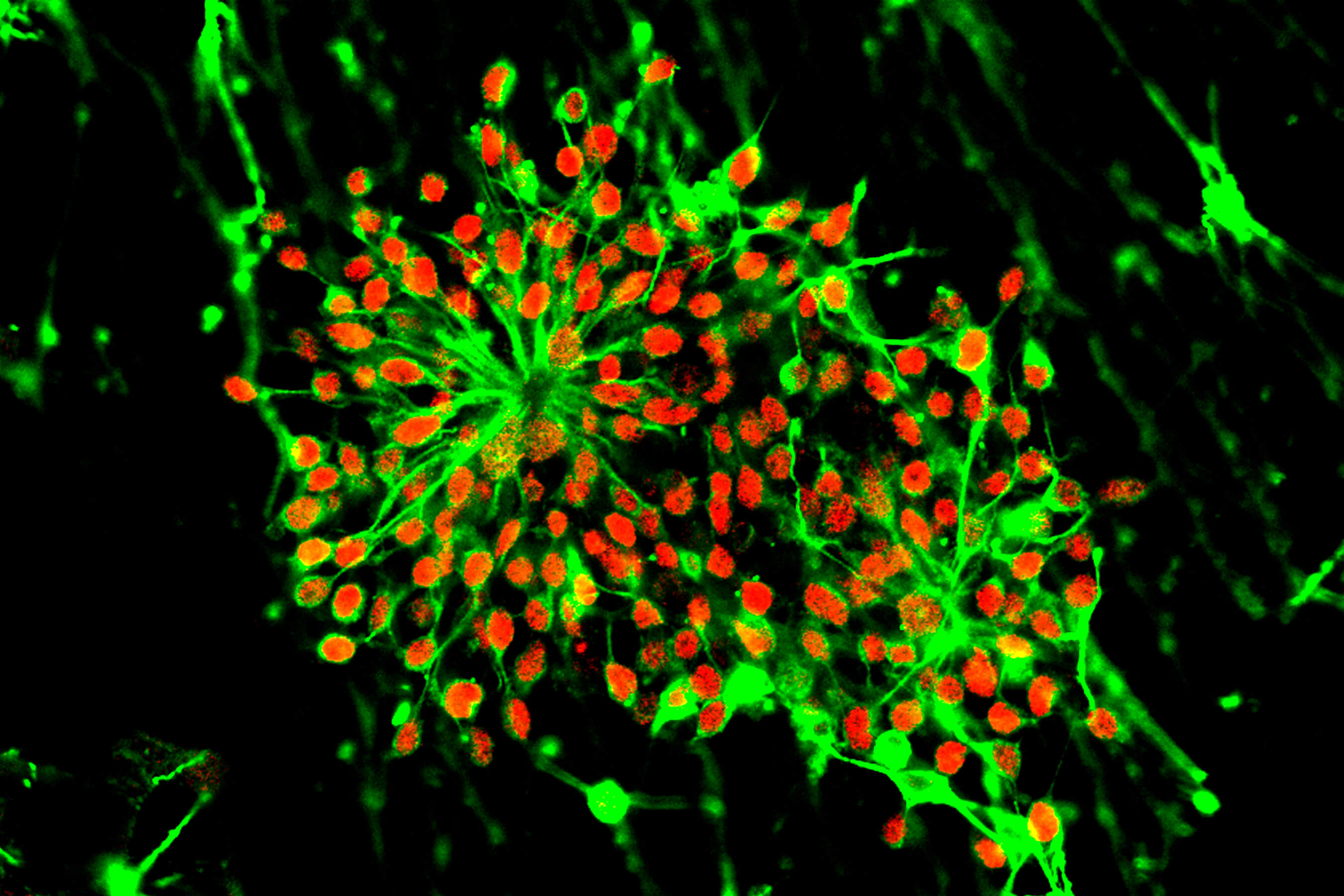 Младенческие кровяные стволовые клетки. Фото.