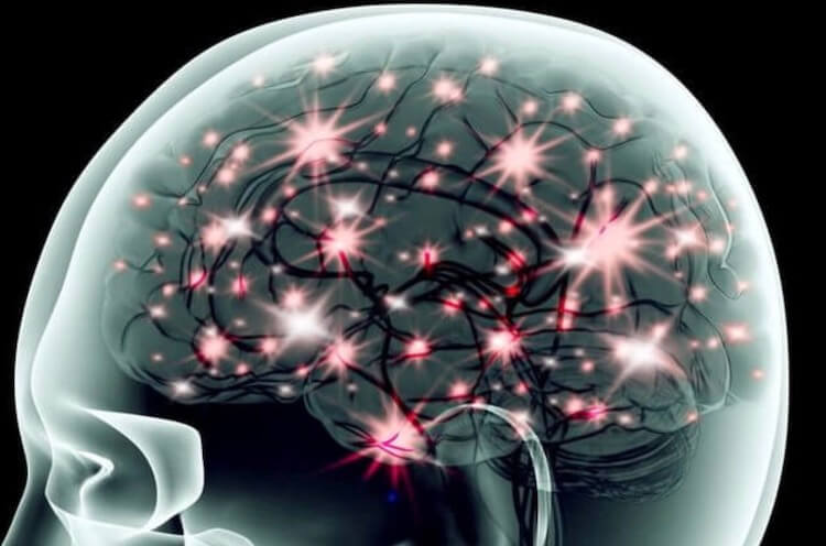 Модель активации-синтеза. Мозг должен работать правильно. Модель активации-синтеза. Мозг должен работать правильно. Фото.