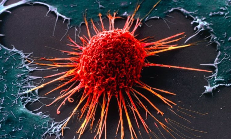 Новый тест позволит выявить рак за 10 лет до его появления. Фото.