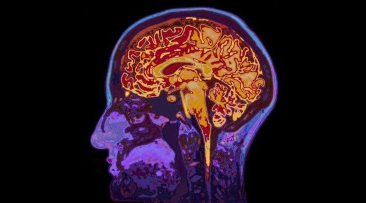 Можно ли улучшать мозг? Мозг очень сложен и интересен. Фото.