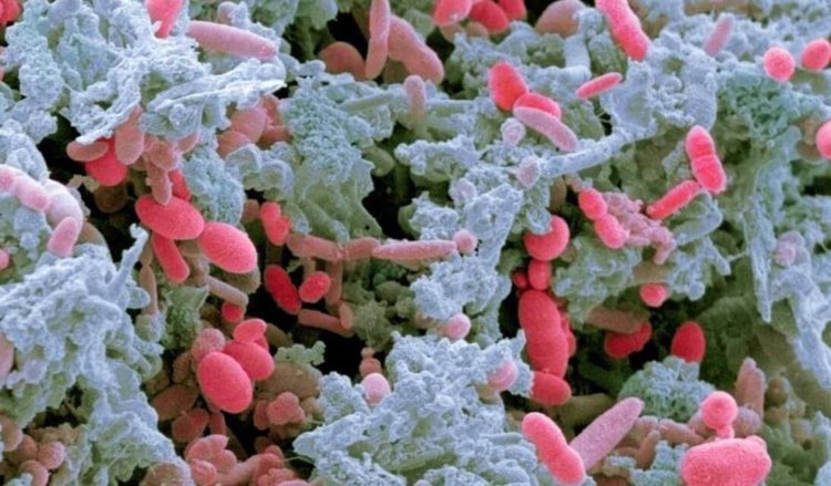 IBM начала исследование человеческого микробиома и его влияния на здоровье. Фото.