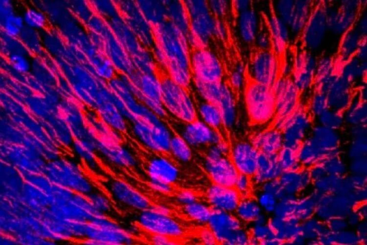 Мозговые шарики тоже делали в лаборатории. Фото.