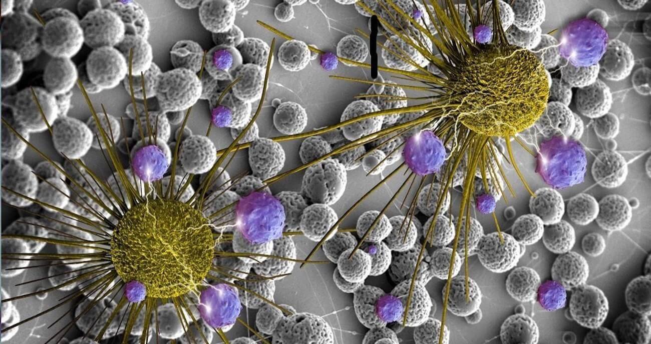 Найден способ «усыплять» раковые клетки. Фото.