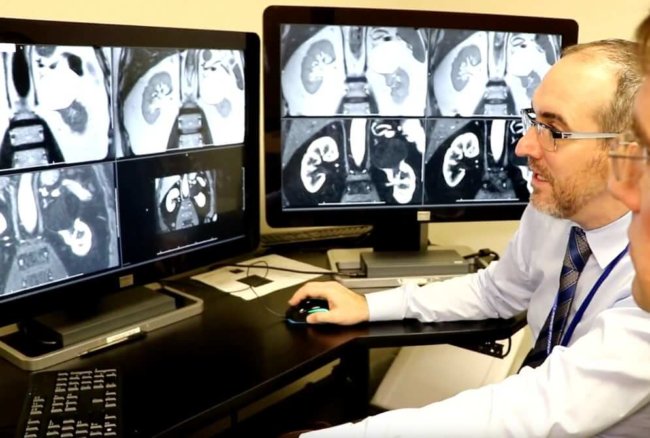 Найден способ определения злокачественности опухоли без использования биопсии. Фото.