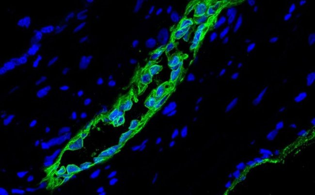 Учёные открыли новую разновидность стволовых клеток. Фото.