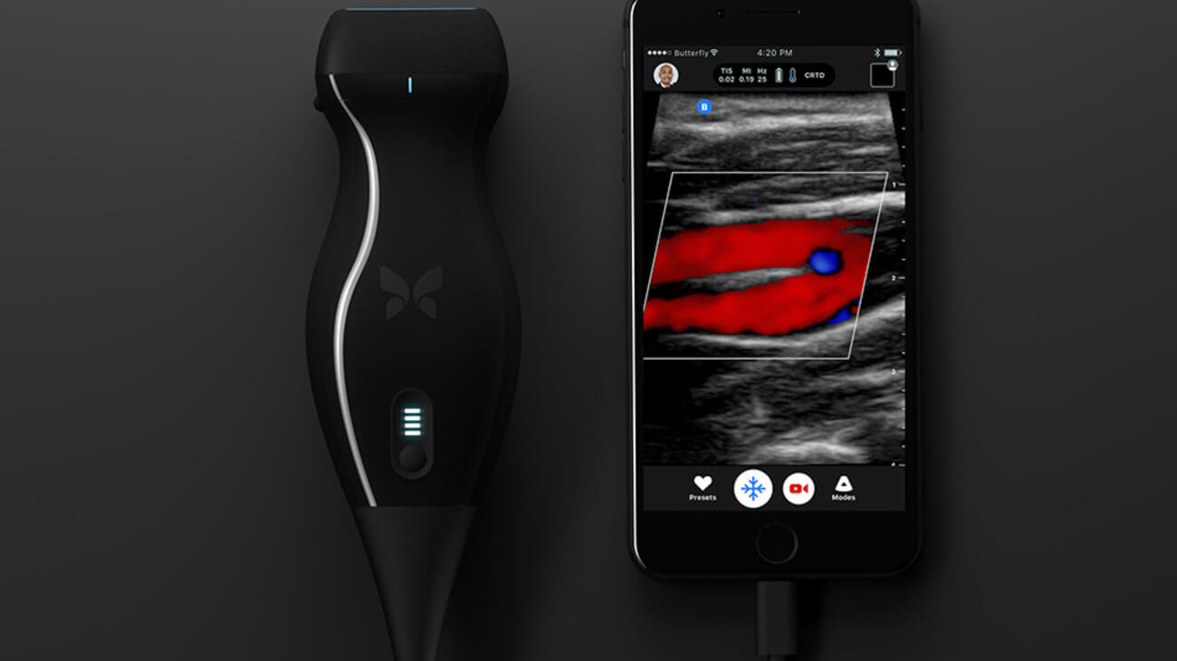 Разработан самый портативный и самый дешевый аппарат УЗИ.. Фото.