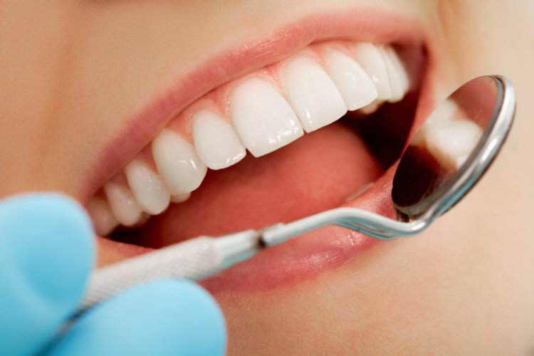 Канадские ученые создали почти вечные зубные пломбы. Фото.