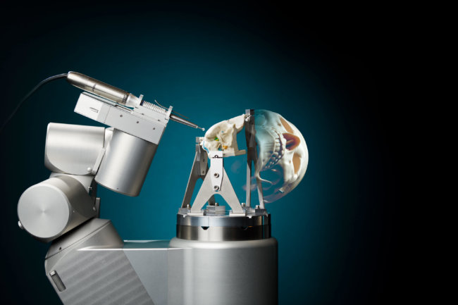 RoBoSculpt: первый робот-хирург, который может сделать трепанацию черепа. Фото.