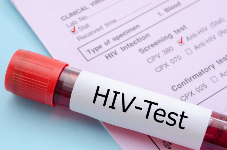 Новая вакцина от ВИЧ показала хорошие результаты в испытаниях на людях. Фото.