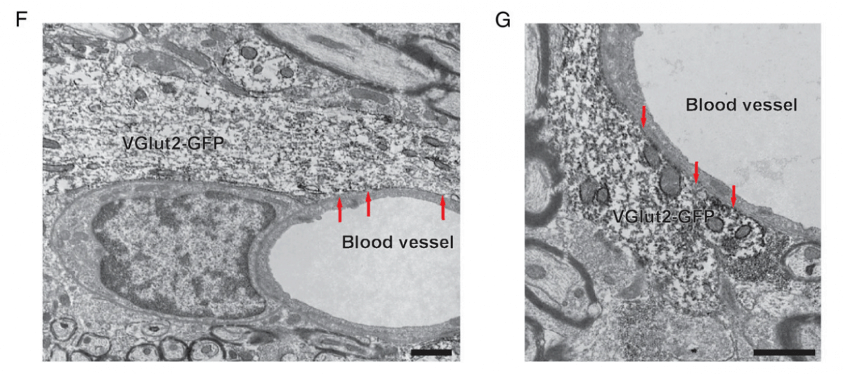 Обнаружены нейроны, отвечающие за сознание. Фото.