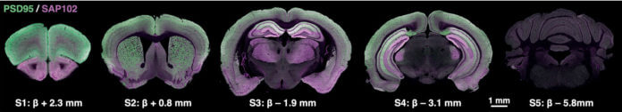 Карта синаптомы. Мозг мышки. Фото.