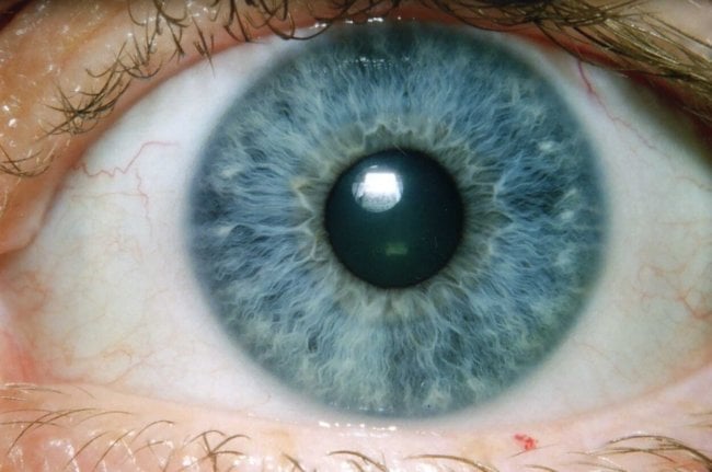 Google создали ИИ для диагностики глазных болезней. Фото.