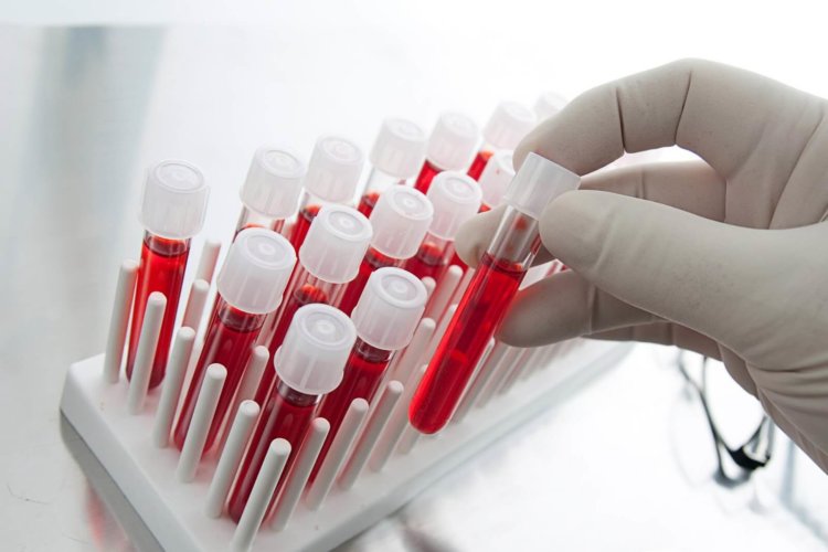 Новый анализ крови поможет узнать о риске рецидива рака. Фото.