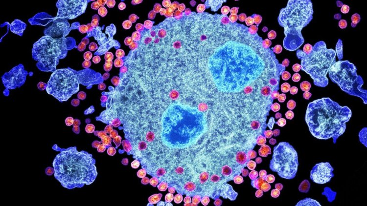 Экспериментальная иммунотерапия ВИЧ прошла первый этап испытаний безопасности. Фото.