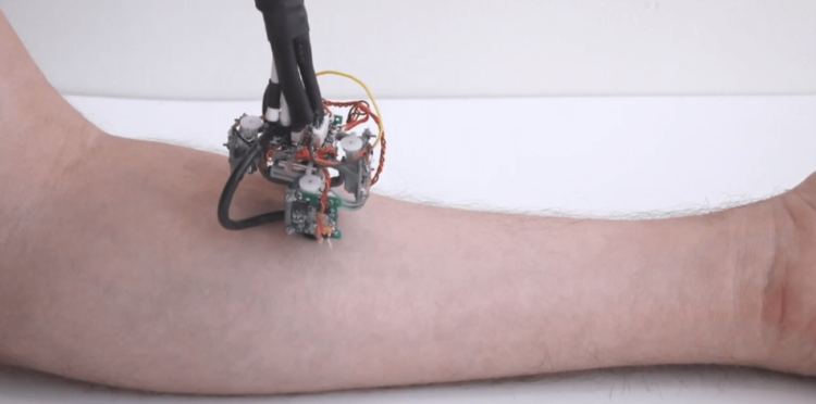 В MIT создали передвигающегося по человеческому телу робота-диагноста. Фото.
