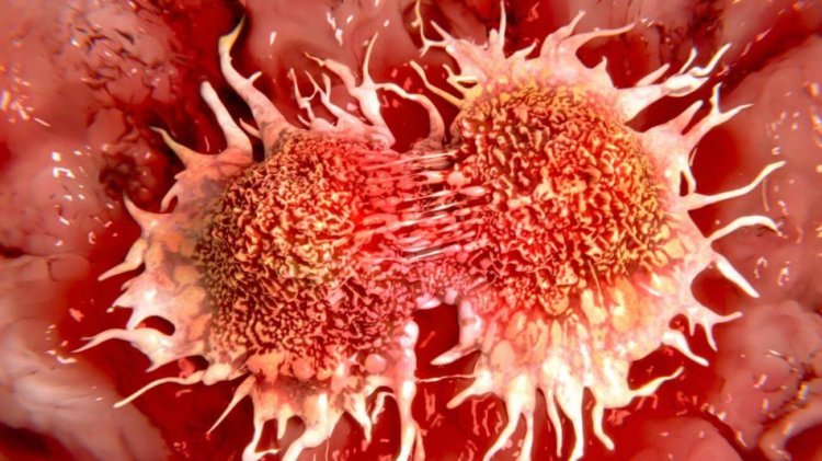Новая технология позволяет обнаружить рак легких на самой ранней стадии. Фото.