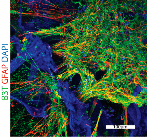 Ученые вырастили нейронную сеть из человеческих стволовых клеток. Фото.
