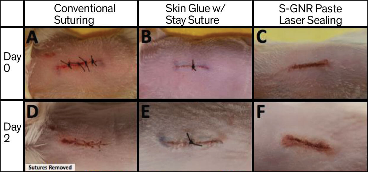 Ученые создают лазерный кожный регенератор из «Стартрека». Фото.
