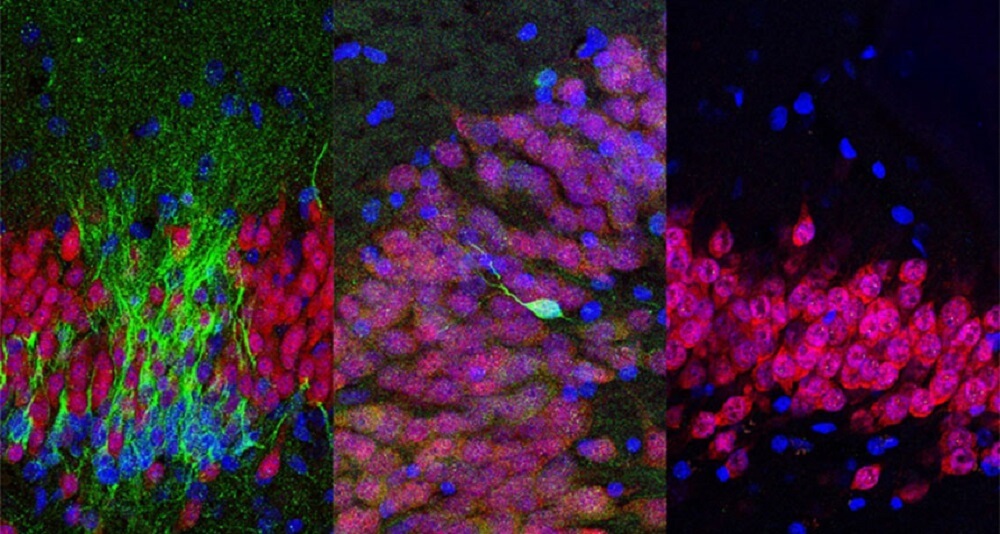 И все же, появляются ли у взрослого мозга новые нервные клетки? Фото.