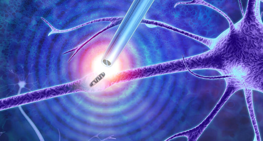 Новые пинцеты позволят ученым проводить биопсию живых клеток. Новые пинцеты позволят ученым проводить биопсию живых клеток. Фото.