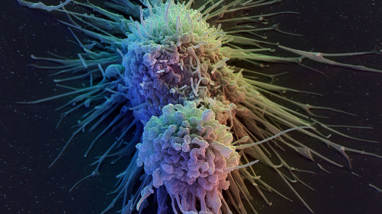 Из клеток кожи сделали клетки иммунитета. И это поможет в лечении рака. Фото.