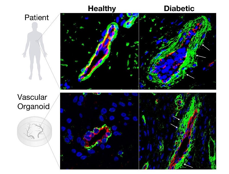 Ученые вырастили в лаборатори идеальные человеческие кровеносные сосуды. Фото.