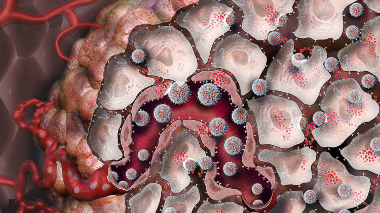 Как наноматериалы помогут в борьбе с опухолями? Фото.