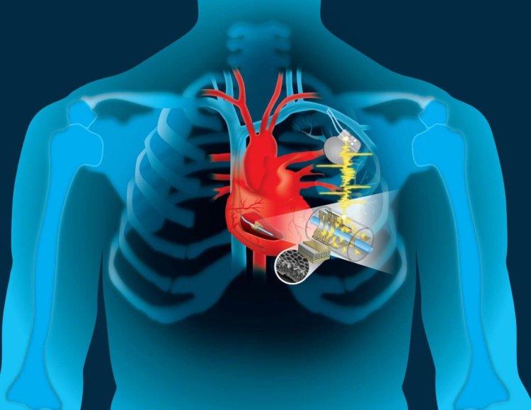 Вечный «мотор»: энергию сердца можно использовать для подзарядки кардиостимуляторов. Фото.