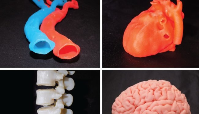 Найден способ сохранять клетки живыми при 3D-печати больших органов. Фото.