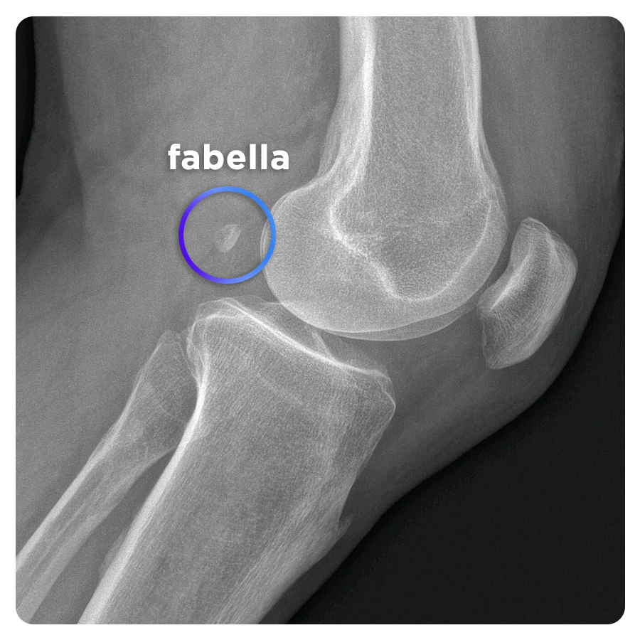 Кость Фабелла
