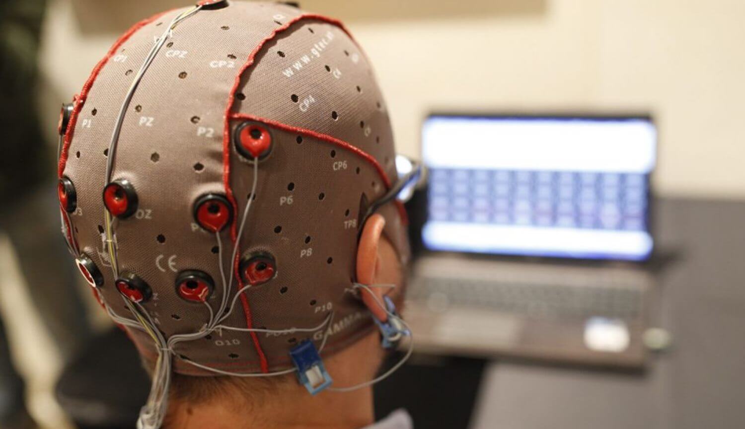 Электрическая стимуляция мозга