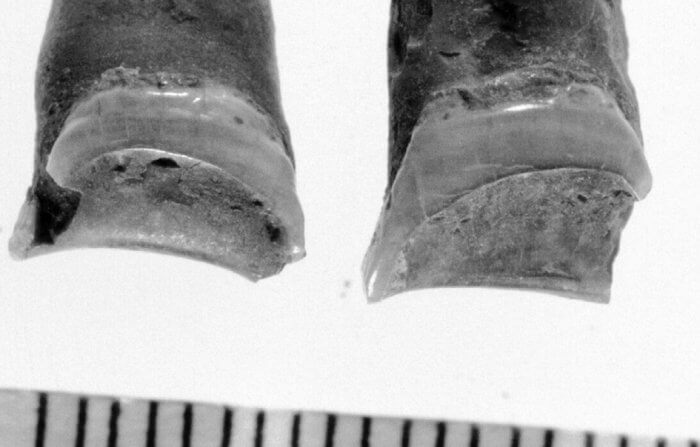 Профессия древнеегипетской женщины была определена по останкам ее зубов. Фото.