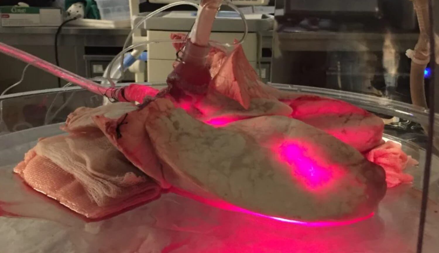 Создана технология для полного истребления вирусов в донорских органах. Создана технология для полного истребления вирусов в донорских органах. Фото.