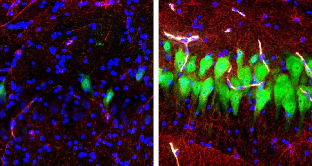 Свиньи-зомби: ученые «воскресили» мозг свиньи через четыре часа после смерти.. Фото.