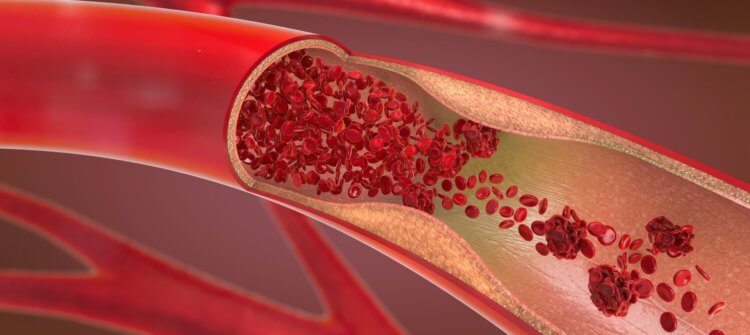 Создан гидрогель, способный остановить артериальное кровотечение. Фото.