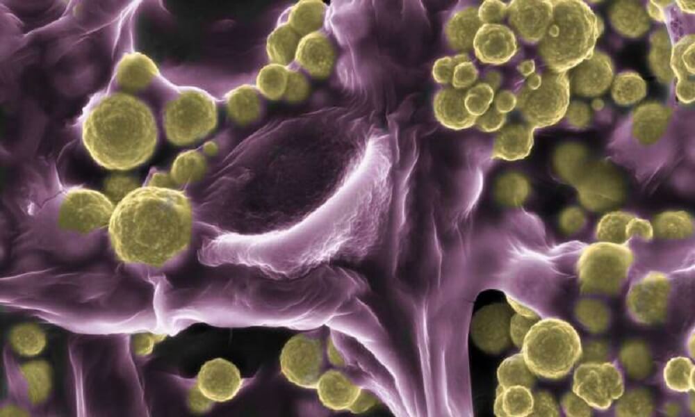 Золотые грибы — новые золотоискатели.. Фото.