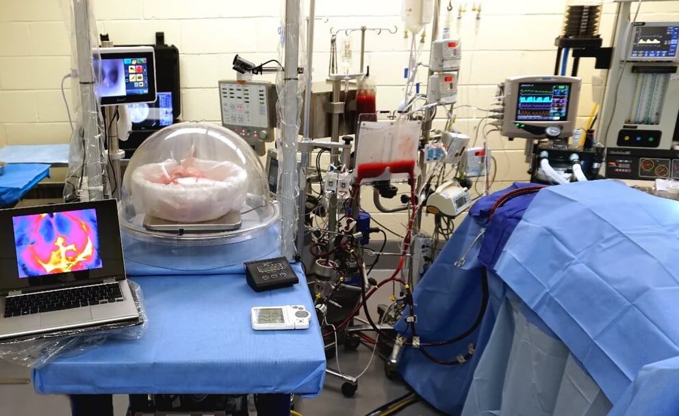 Ученые успешно вылечили поврежденное легкое — дефициту донорских органов настанет конец.. Фото.