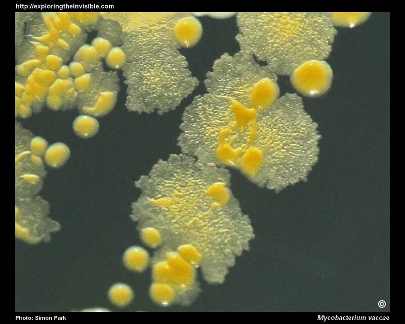 Вакцина от последствий стресса уже в разработке. В ее состав входит живущая в грязи бактерия.. Как бактерии укрепляют иммунитет?. Фото.